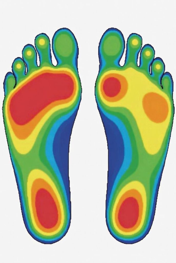 pressure distribution on the foot before and after insole repair